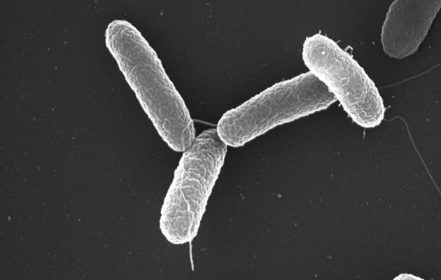 Lidí s problémy po jídle z hradecké restaurace přibylo, část má salmonelózu